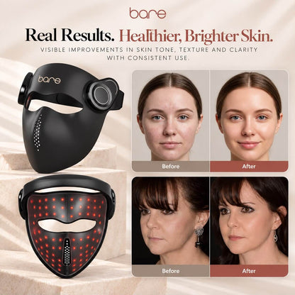 Bare Lumina PRO™ Laser + LED Therapy Mask